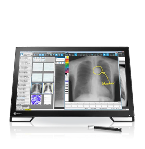 EIZO-藝卓-RadiForce-23"-MS236WT-LBK-觸控式醫療平面顯示器-(-IPS--1920x1080--60Hz--VAG,DVI-D&DP---VESA100)