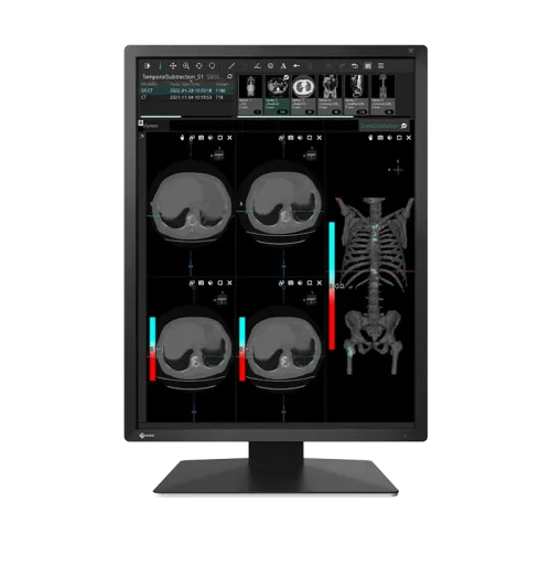 EIZO-藝卓-RadiForce-21.3"-MX217-BK-醫療平面顯示器-(-IPS--1200x1600--60Hz--DVI-D&DP--VESA100--高低升降)