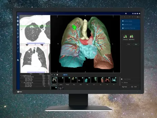 EIZO-藝卓-RadiForce-24.1"-MX243W-BK-醫療平面顯示器-(-IPS--1920x1200--60Hz--DVI-D&DP--VESA100--高低升降)